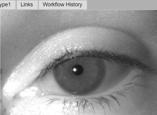 photo of retina iris capture